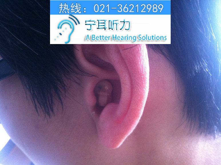 上海西門子助聽器專賣店寧耳聽力特價提供最優良的聽力技術工廠,批發,進口,代購