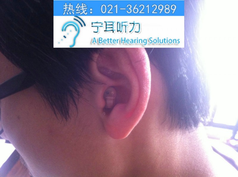 上海閘北哪裡買助聽器好西門子/奧迪康/瑞聲達/峰力助聽器折扣工廠,批發,進口,代購