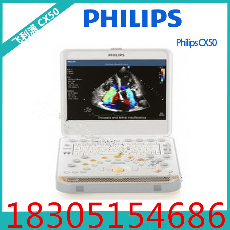 飛利浦Philips CX50高端便攜式彩超 /進口  /恒騰工廠,批發,進口,代購