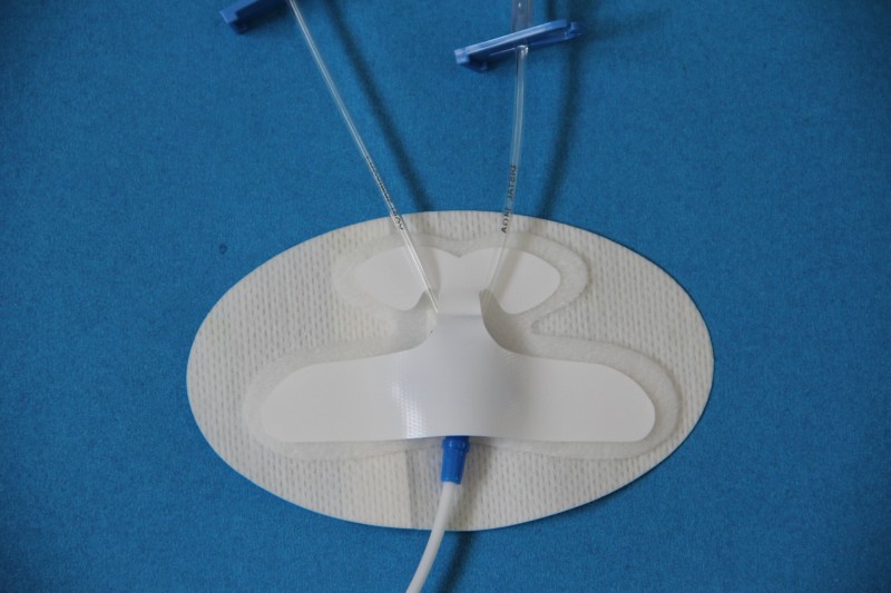 創奇導管固定貼一次性導管固定貼跟3M產品一樣工廠,批發,進口,代購