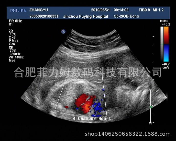 熱銷B5 16k瓷白噴墨膠片 醫用B超彩超胃鏡打印膠片 150厚PET膠片批發・進口・工廠・代買・代購