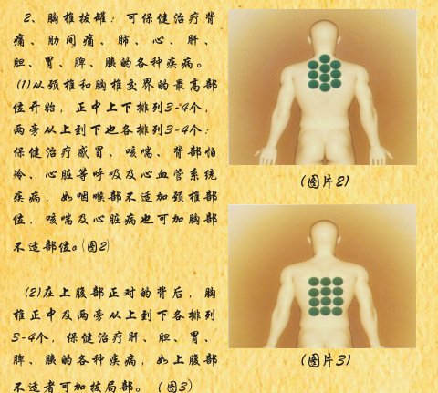 專利品牌廠傢批發五行能量罐  五行養生罐  功能電療罐工廠,批發,進口,代購