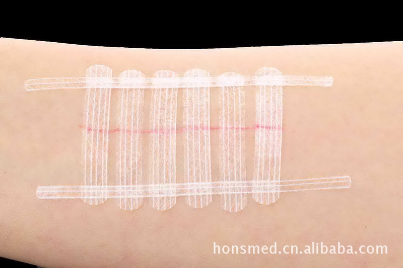 免縫膠帶 拉合膠帶 美容膠帶Skin Closure Wound Closure Strips工廠,批發,進口,代購