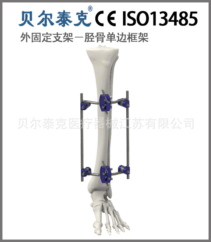 骨科三維固定的模塊式外固定支架多功能型脛骨單邊框架工廠,批發,進口,代購