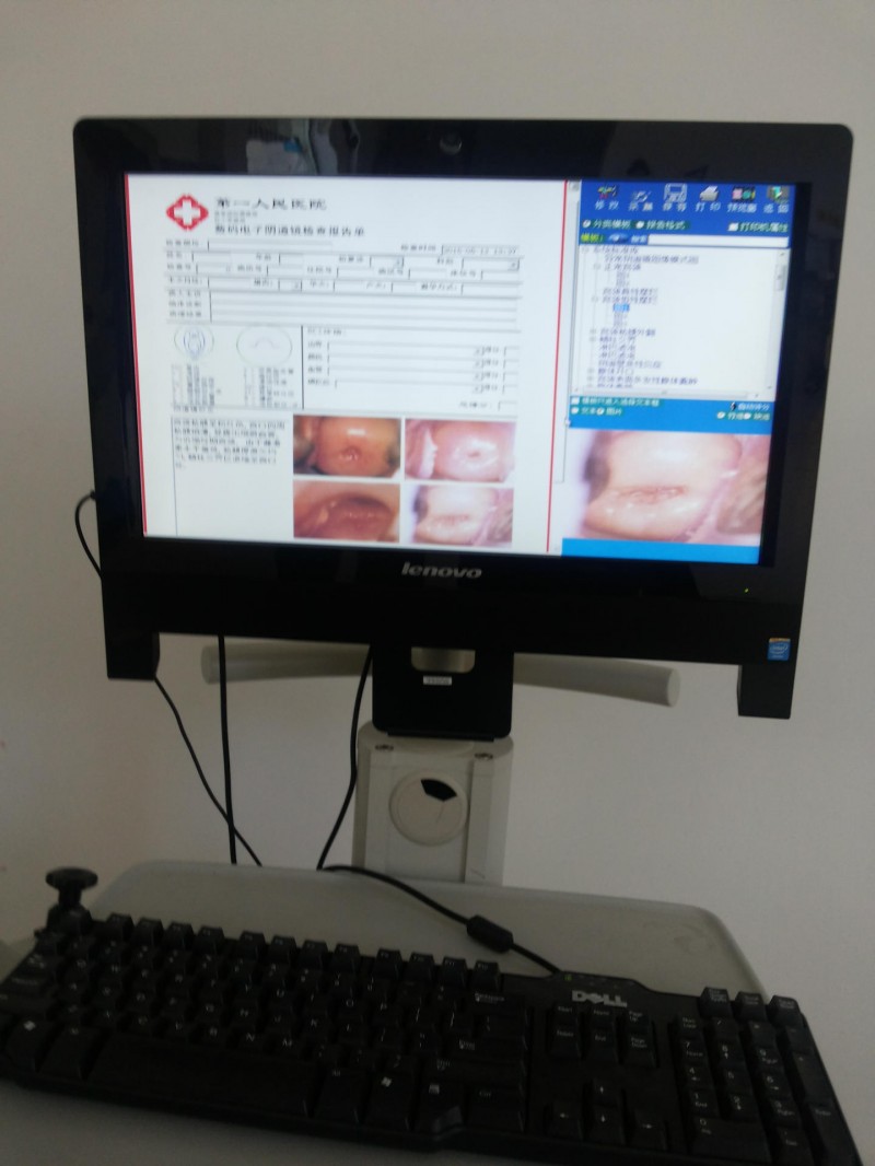 宮頸炎檢查機 光學陰道鏡LC-9200C高清原裝進口/醫用內窺鏡工廠,批發,進口,代購