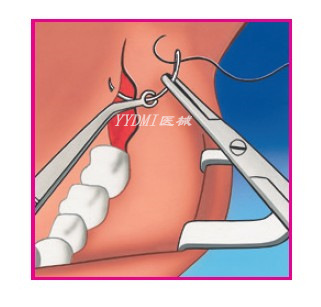 【YYDMI】縫合鑷 suture tweezers 德國進口不銹鋼 種植工具工廠,批發,進口,代購