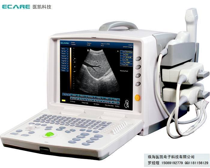 醫凱超聲廠價，銷售黑白數字超，便攜超，彩超四維超批發・進口・工廠・代買・代購