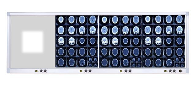 北京產手術室電腦調光調幅四聯超薄高亮閱片燈醫用LED智能觀片燈批發・進口・工廠・代買・代購