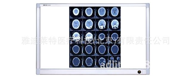 北京廠傢直銷桌立式雙聯超薄液晶閱片燈標準LED醫用觀片燈批發・進口・工廠・代買・代購