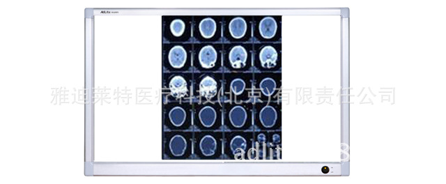 北京廠傢直銷手術室雙聯超薄液晶閱片燈標準LED醫用觀片燈批發・進口・工廠・代買・代購