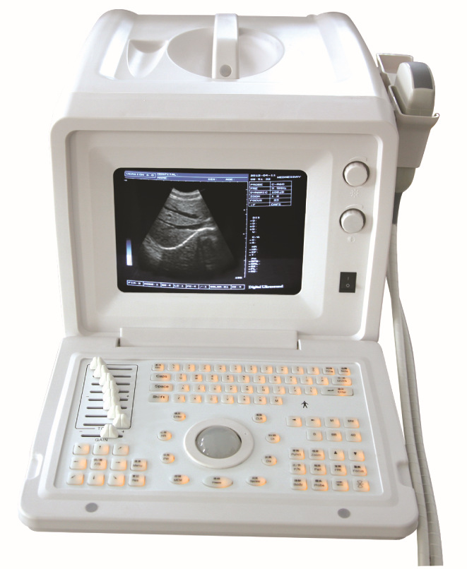 供應凱爾系列便攜式B超，便攜B超批發・進口・工廠・代買・代購