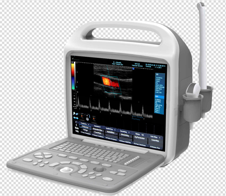 2D手提彩超/筆記本式彩超/廠傢直供工廠,批發,進口,代購