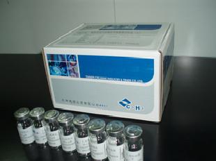 單純皰疹病毒I 型IgM ELISA試劑盒工廠,批發,進口,代購