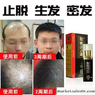 供應藥妝招商 知醫堂發根活素 防脫止脫生發產品 治療脫發工廠,批發,進口,代購