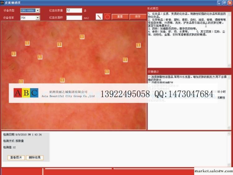 ABC正品 臺式電腦觸摸一體化自動皮膚分析儀工廠,批發,進口,代購