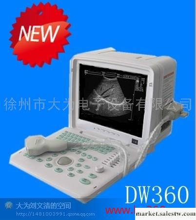 供應DW360全數字便攜式B超 B超機 B超機價格大為公司B超機工廠,批發,進口,代購