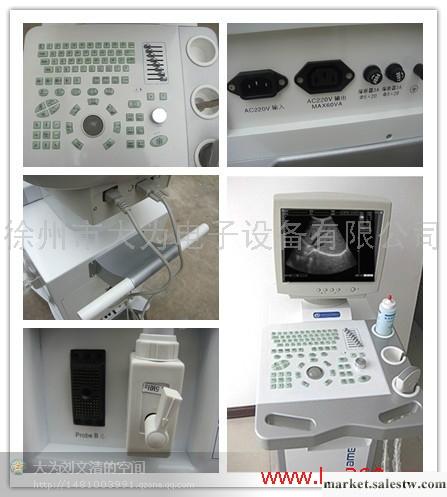 供應DW350推車式大為公司B超儀器工廠,批發,進口,代購